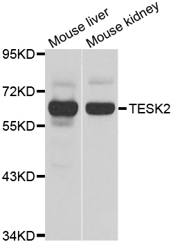 Western blot - TESK2 Polyclonal Antibody 