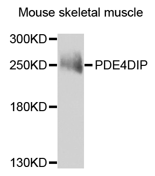 Western blot - PDE4DIP Polyclonal Antibody 