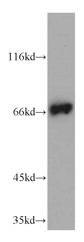 Jurkat cells were subjected to SDS PAGE followed by western blot with Catalog No:111950(ITK antibody) at dilution of 1:300