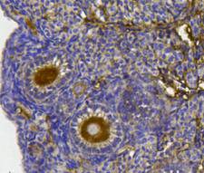 Fig4: Immunohistochemical analysis of paraffin- embedded mouse ovary tissue using anti-YB1 rabbit polyclonal antibody.