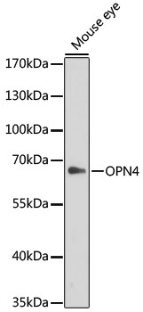 Western blot - OPN4 Polyclonal Antibody 