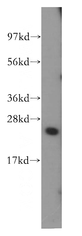 HeLa cells were subjected to SDS PAGE followed by western blot with Catalog No:115647(SPRR3 antibody) at dilution of 1:400