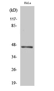 Fig1:; Western Blot analysis of various cells using ACOT4 Polyclonal Antibody diluted at 1: 1000