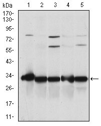 Western blot analysis using NQO1 mouse mAb against A549 (1), SKNES (2), HepG2 (3), MCF-7 (4) and Hela (5) cell lysate.