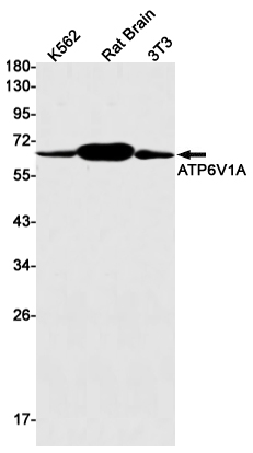 Western blot detection of ATP6V1A in K562,Rat Brain,3T3 cell lysates using ATP6V1A Rabbit mAb(1:1000 diluted).Predicted band size:68kDa.Observed band size:68kDa.