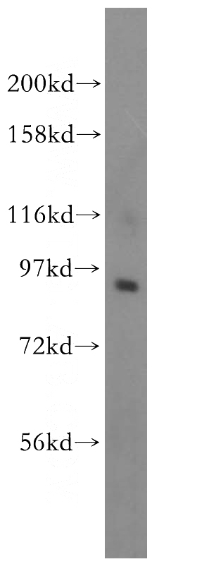 mouse lymph tissue were subjected to SDS PAGE followed by western blot with Catalog No:115105(SEMA4B antibody) at dilution of 1:400