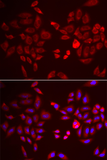 Immunofluorescence - PDK4 Polyclonal Antibody 