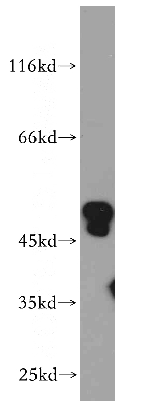 HeLa cells were subjected to SDS PAGE followed by western blot with Catalog No:108063(ANKMY2 antibody) at dilution of 1:500