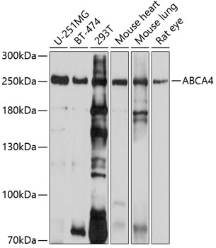 Western blot - ABCA4 Polyclonal Antibody 