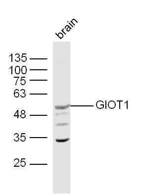 Fig1: Sample:; Brain (Mouse) Lysate at 40 ug; Primary: Anti-GIOT1 at 1/300 dilution; Secondary: IRDye800CW Goat Anti-Rabbit IgG at 1/20000 dilution; Predicted band size: 66 kD; Observed band size: 52 kD