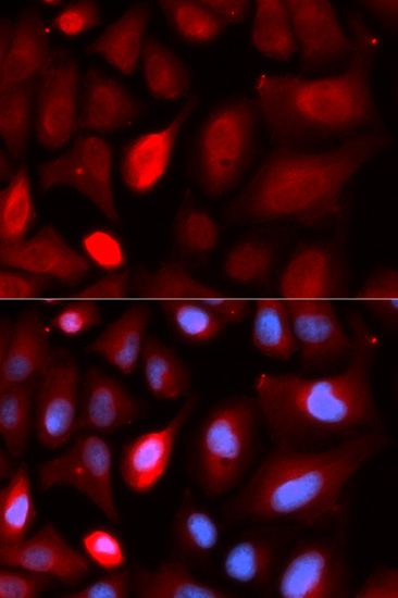 Immunofluorescence - PDLIM5 Polyclonal Antibody 