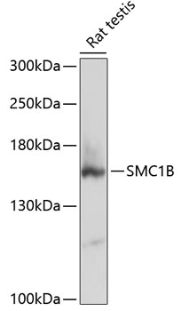 Western blot - SMC1B Polyclonal Antibody 