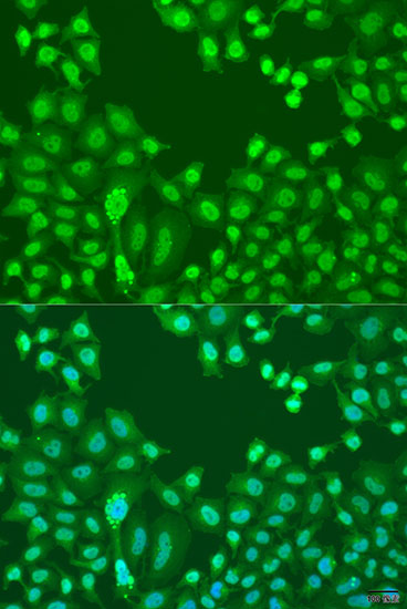 Immunofluorescence - CTCF Polyclonal Antibody 