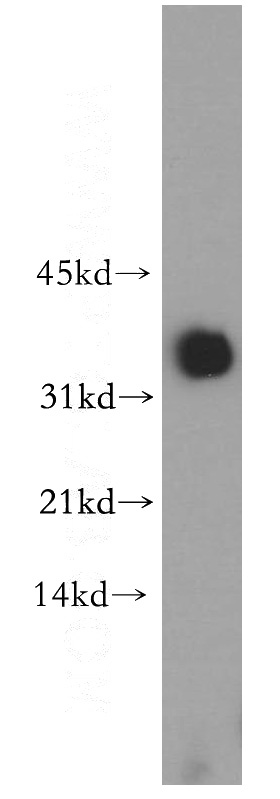 human heart tissue were subjected to SDS PAGE followed by western blot with Catalog No:113679(PDHB antibody) at dilution of 1:300