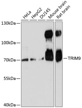 Western blot - TRIM9 Polyclonal Antibody 