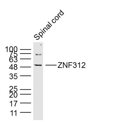 Fig2: Sample: Spinal cord (Mouse) Lysate at 40 ug; Primary: Anti-ZNF312 at 1/300 dilution; Secondary: IRDye800CW Goat Anti-Rabbit IgG at 1/20000 dilution; Predicted band size: 49 kD; Observed band size: 49 kD