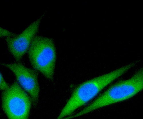 Fig4: ICC staining C19orf35 in PC-3M cells (green). The nuclear counter stain is DAPI (blue). Cells were fixed in paraformaldehyde, permeabilised with 0.25% Triton X100/PBS.