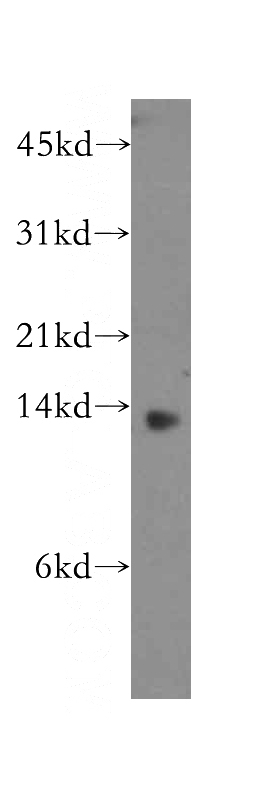 human stomach tissue were subjected to SDS PAGE followed by western blot with Catalog No:110968(GHRL antibody) at dilution of 1:400