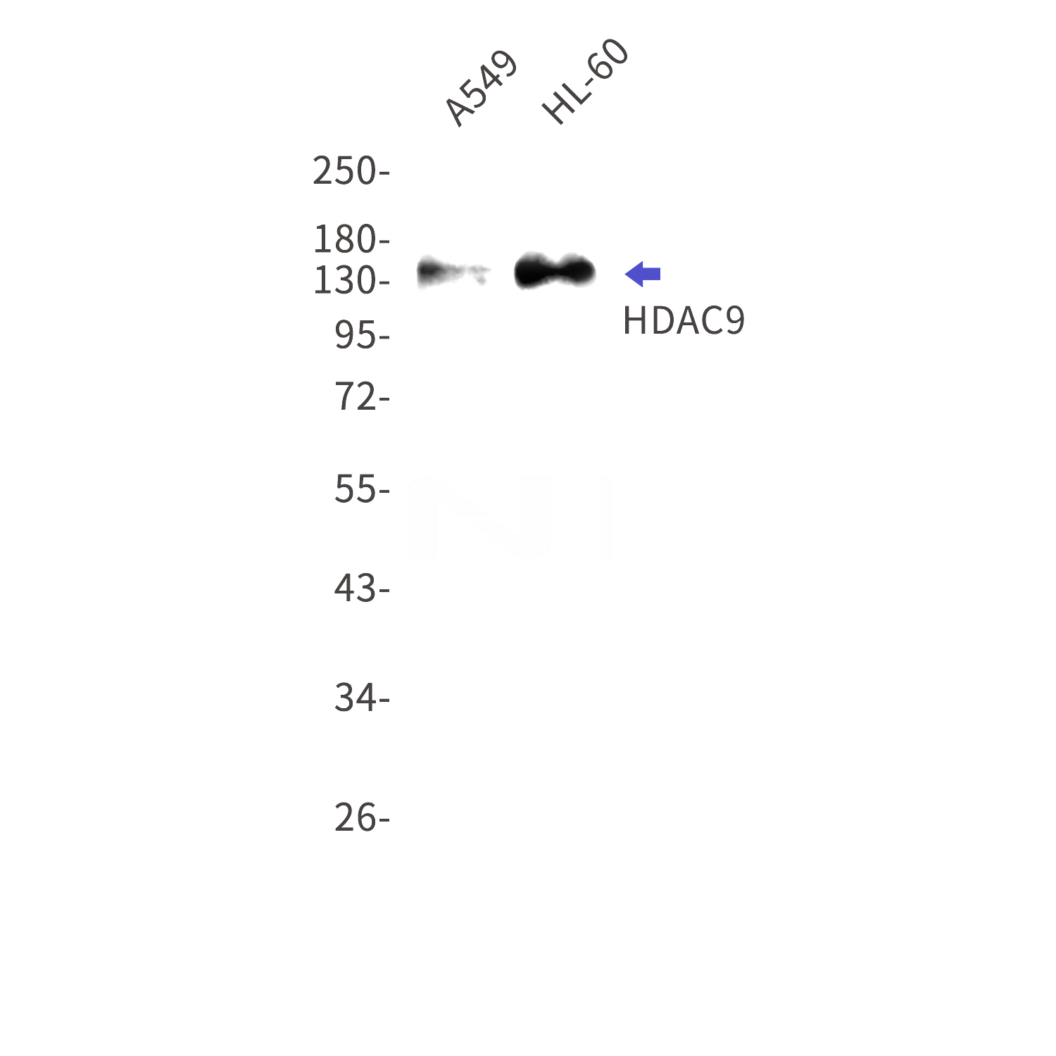 Western blot detection of HDAC9 in A549,HL-60 cell lysates using HDAC9 Rabbit mAb(1:1000 diluted).Predicted band size:111kDa.Observed band size:150kDa.