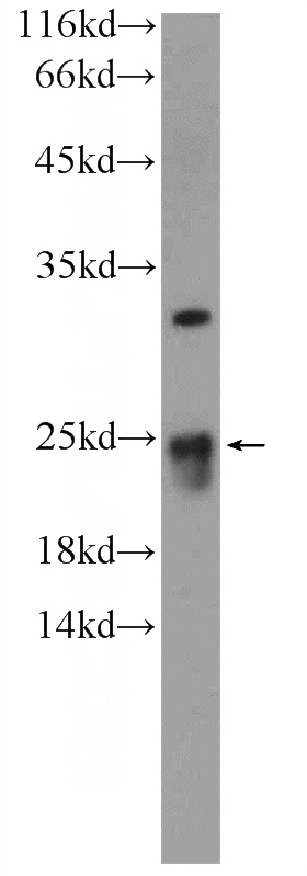 HEK-293 cells were subjected to SDS PAGE followed by western blot with Catalog No:110573(FAM158A Antibody) at dilution of 1:300