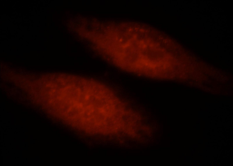 Immunofluorescent analysis of Hela cells, using HIF1A antibody Catalog No:111345 at 1:25 dilution and Rhodamine-labeled goat anti-rabbit IgG (red).