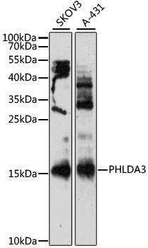 Western blot - PHLDA3 Polyclonal Antibody 
