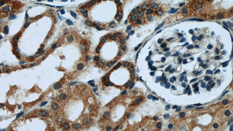 Immunohistochemical of paraffin-embedded human kidney using Catalog No:110609(FDX1 antibody) at dilution of 1:50 (under 40x lens)