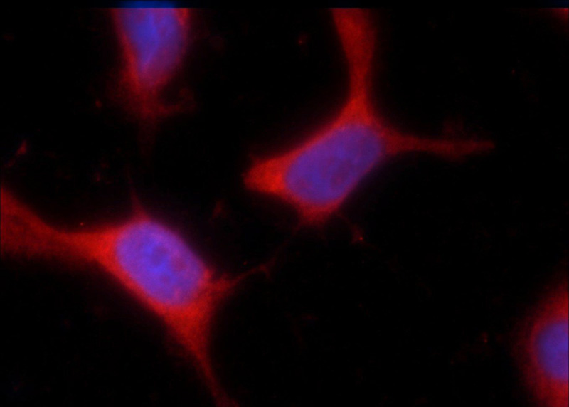 Immunofluorescent analysis of HEK-293 cells using Catalog No:115539(SPANXA2 Antibody) at dilution of 1:25 and Rhodamine-Goat anti-Rabbit IgG