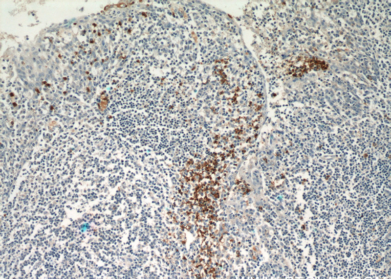 Immunohistochemical of paraffin-embedded human tonsillitis using Catalog No:109634(CX3CR1 antibody) at dilution of 1:50 (under 10x lens)