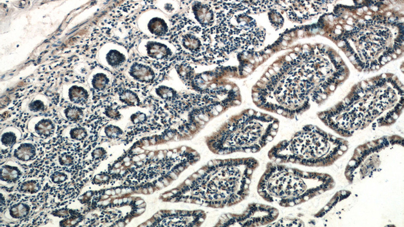 Immunohistochemistry of paraffin-embedded human small intestine slide using Catalog No:109633(CX3CL1 Antibody) at dilution of 1:50 (under 10x lens)