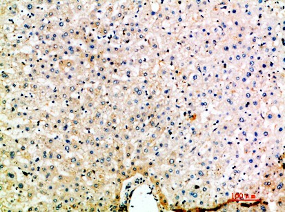 Fig1:; Immunohistochemical analysis of paraffin-embedded human-liver, antibody was diluted at 1:200
