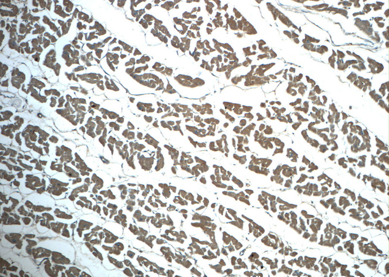 Immunohistochemistry of paraffin-embedded human heart slide using Catalog No:115484(SNX6 Antibody) at dilution of 1:50 (under 10x lens)