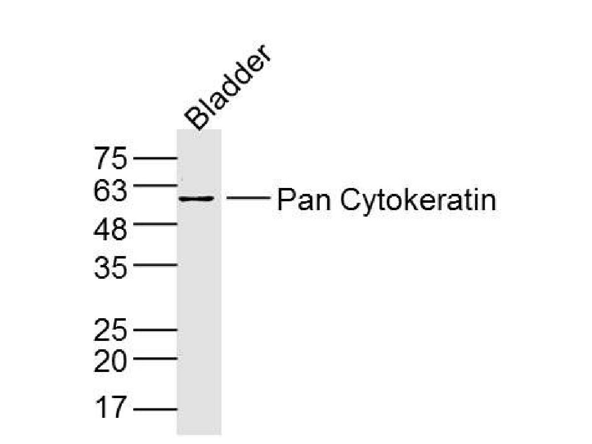 Fig2: Sample:Bladder (Mouse) Lysate at 40 ug; Primary: Anti-Pan Cytokeratin at 1/300 dilution; Secondary: IRDye800CW Goat Anti-Rabbit IgG at 1/20000 dilution; Predicted band size: 42-64 kD; Observed band size: 60 kD