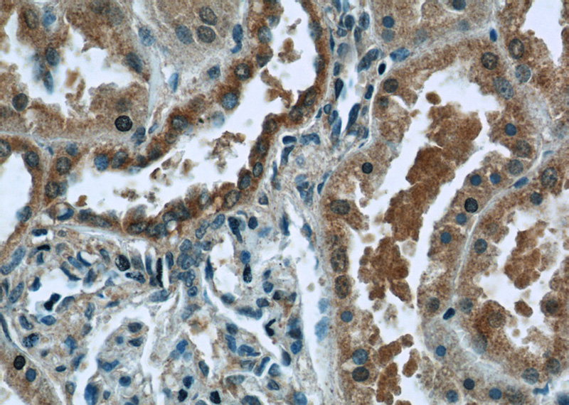 Immunohistochemistry of paraffin-embedded human kidney tissue slide using Catalog No:116976(WWC2 Antibody) at dilution of 1:50 (under 40x lens)
