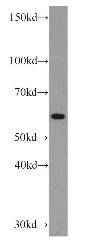 HepG2 cells were subjected to SDS PAGE followed by western blot with Catalog No:107503(RBPJ antibody) at dilution of 1:1000