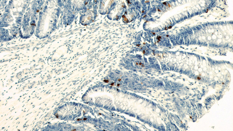 Immunohistochemical of paraffin-embedded human colon using Catalog No:109288(CHGA antibody) at dilution of 1:800 (under 10x lens)