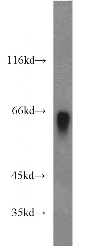 human blood tissue were subjected to SDS PAGE followed by western blot with Catalog No:111290(HPX antibody) at dilution of 1:2000