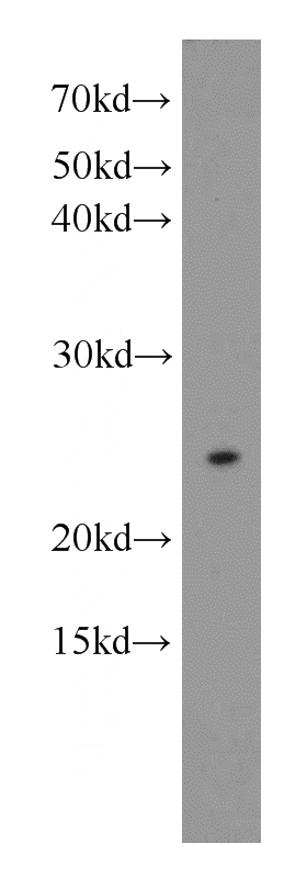 HEK-293 cells were subjected to SDS PAGE followed by western blot with Catalog No:113008(N6AMT1 antibody) at dilution of 1:600