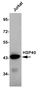 Western blot detection of HSP40 in Jurkat cell lysates using HSP40 Mouse mAb(1:1000 diluted).Predicted band size:40KDa.Observed band size:40KDa.
