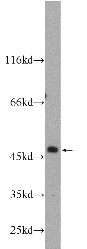 HepG2 cells were subjected to SDS PAGE followed by western blot with Catalog No:117004(ZNF557 Antibody) at dilution of 1:500