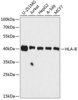 Western blot - HLA-B Polyclonal Antibody 