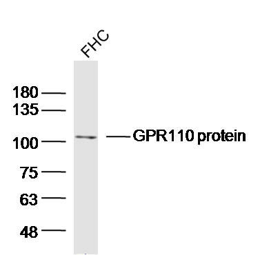 Fig1: Sample:FHC (Human)cell Lysate at 40 ug; Primary: Anti-GPR110 protein at 1/300 dilution; Secondary: IRDye800CW Goat Anti-RabbitIgG at 1/20000 dilution; Predicted band size: 99kD; Observed band size: 105kD