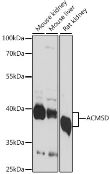 Western blot - ACMSD Polyclonal Antibody 