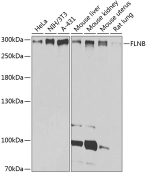 Western blot - FLNB Polyclonal Antibody 