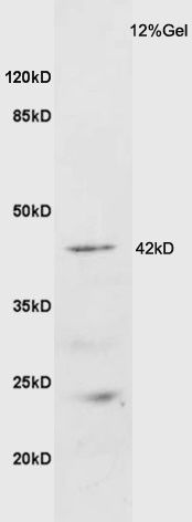 Fig1: Sample: Brain (Mouse) Lysate at 40 ug; Primary: Anti-GALR2 at 1/300 dilution; Secondary: HRP conjugated Goat-Anti-rabbit IgG (bs-0295G-HRP) at 1/5000 dilution; Predicted band size: 42 kD; Observed band size: 42 kD