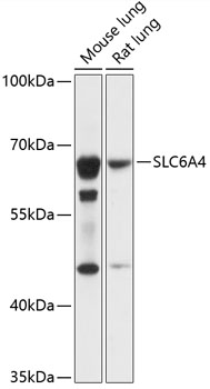 Western blot - SLC6A4 Polyclonal Antibody 