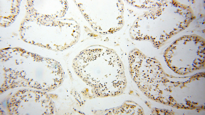 Immunohistochemical of paraffin-embedded human testis using Catalog No:109776(DDR1 antibody) at dilution of 1:50 (under 10x lens)