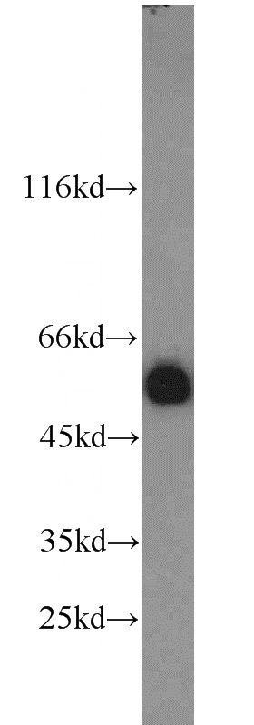 HeLa cells were subjected to SDS PAGE followed by western blot with Catalog No:109771(DDB2 antibody) at dilution of 1:1000