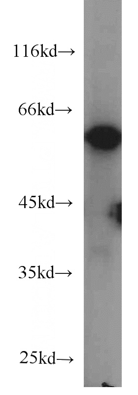 MCF7 cells were subjected to SDS PAGE followed by western blot with Catalog No:107246(ECM1 antibody) at dilution of 1:500