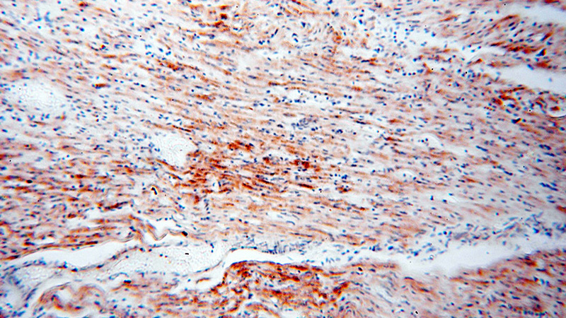 Immunohistochemical of paraffin-embedded human heart using Catalog No:109470(COQ5 antibody) at dilution of 1:100 (under 10x lens)